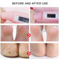 Foot Cream Hand Foot Care Cream Moisturizing Anti-Aging Body Skin Moisturizing Removal Hand Care Mask Feet Pedicur. 