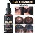 Beauty Mafia Hair Growth Oil | Biotin Essential Oils Complex for Strong and thicker Fuller Hair | 100% Natural Formula 30ml. 