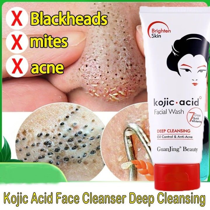 Kojic Acid Face Deep Cleansing Face Wash Oil Control Anti Acne 100g