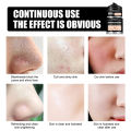 Nose Blackhead Remover Mask Deep Cleansing Skin Care Shrink Pore Acne Treatment Mask Nose Black dots Pore Clean. 
