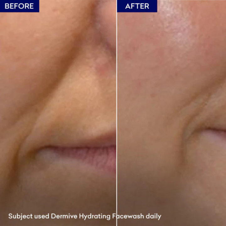 Dermive%20Moisturizing%20Face%20Wash%20for%20Dry%20&%20Sensitive%20Skin%20%7C%20Gentle%20Cleanser,%20Barrier%20Repair,%20Hydrating%20&%20Soothing%20%7C%20Eczema-Prone%20Skin%20%7C%20100ml%20-%20Image%208