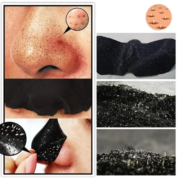10pcs%20Nose%20Blackhead%20Remover%20Strips%20Mask%20Skin%20Care%20Shrink%20Pore%20Acne%20Treatment%20Mask%20Deep%20Nose%20Pore%20Cleansing%20Strips%20Black%20Head%20Remover,%20Charcoal%20Blackhead%20Remover%20Nose%20Mask%20Strips%20for%20Nose%20Cleansing%20Deep%20Clean%20Treatment%20-%20Image%205