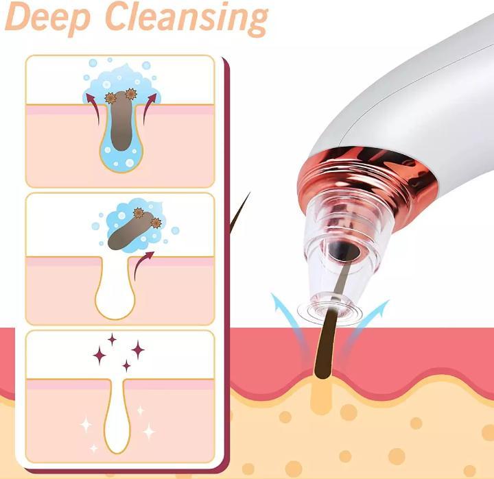 4%20in%201%20Black%20Head%20Remover%20Machine%20-%20Acne%20Pimple%20Pore%20Cleaner%20Vacuum%20Suction%20Tool%20Blackhead%20Removal%20On%20Nose%20Sucking%20Machine%20Blackheads%20Removal%20Device%20Derma%20Suction%20-%20Rechargeable%7C%20SkyScraper%20Store%20-%20Image%207