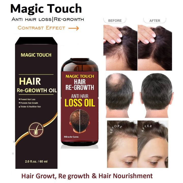 Magic Touch Anti Hair Loss Hair Regrowth Oil 50 ml - Miracle Cures Hair Re Growth by Magic Touch