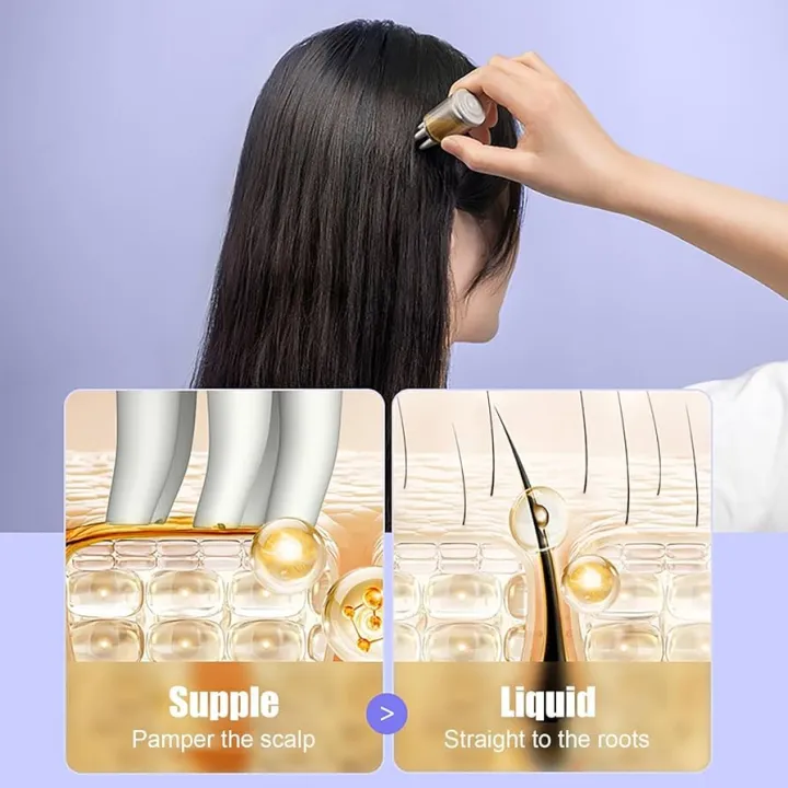 Hair%20Oil%20Bottle%20With%20Comb%20%7C%20Best%20For%20Dandruff%20&%20Hair%20Fall%20%7C%20Anti%20Lice%20Comb%20%7C%20Imported%20Multipurpose%20Applicator%20%7C%20-%20Image%204