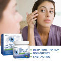 Eye Protection Ointment Herbal Improve Eyesight Treatment Cataract Myopia Glaucoma Relieve Eye Fatigue Dry Itchy Eye Care Cream. 