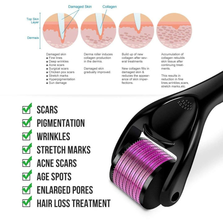 Derma%20Roller%200.5%20Mm%20Hair%20System%20-%20Image%205