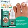 South Moon Premium Nail Fungus Treatment Serum - Effective Nail Repair & Protection for Onychomycosis. 