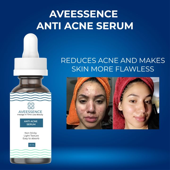 AVEESSENCE Anti acne serum Best anti acne serum for acne-prone skin Acne treatment serum Serum for acne scars Best serum for acne and blemishes Anti acne serum for clear skin Acne-fighting serum for oily skin Acne serum with salicylic acid Natural