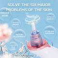 Blackhead Pore Vacuum Black Head Remover Acne Electric Face Skincare Cleaner Tools. 
