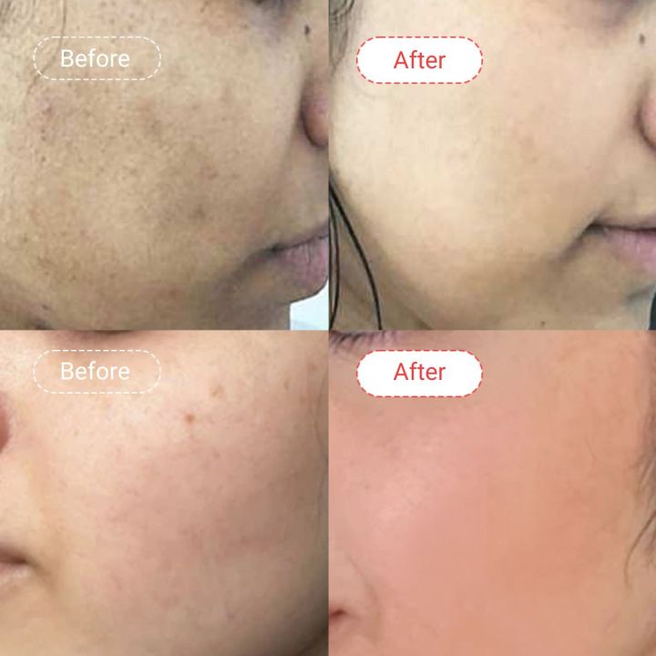AccuFix%20Cosmetics%20Kojic%20Acid%20Glutathione%20Skin%20Brightening%20Cream%20%7C%20Avaiable%20in%2050g%20&%2030g%20-%20Image%205