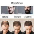 Derma roller 0.5mm hair and beard growth titanium needles best quality for hair growth. 