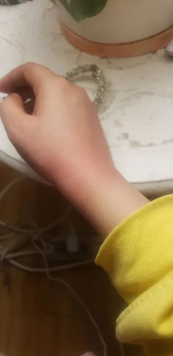 Smooth%20and%20Painless%20Facial%20Hair%20Removal/Exfoliator%20-%20Pack%20of%206%20for%20Unwanted%20By%20Sheer%20Skin%20-%20Beauty%20Tools%20/%20Hair%20Removal%20Accessories%20-%20Image%203