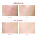 LAIKOU Pro 10% Niacinamide Serum Brightening Lighten Blemishes Dark Spot 17ml. 