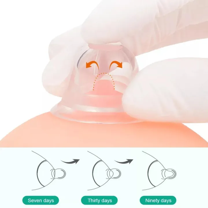 Nipples%20Corrector%20for%20Inverted%20(Day%20&%20Night)%20-%20Image%207