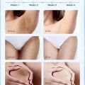 Trimo-skin First Skin Repair Cream, Dark Spot Removal Cream, Anti Freckles Cream, Anti Aging Cream, Skin Repair Cream, New Trimo Skin Cream, Best Skin Repair Treatment, Face Brightening Cream, Elasticity Restoring Cream, Skin Care Products. 