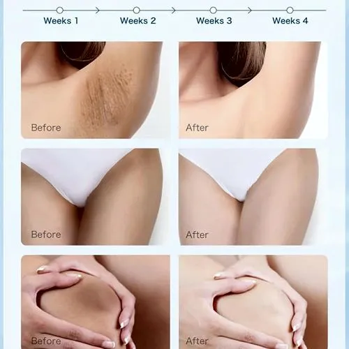 Trimo-skin%20First%20Skin%20Repair%20Cream,%20Dark%20Spot%20Removal%20Cream,%20Anti%20Freckles%20Cream,%20Anti%20Aging%20Cream,%20Skin%20Repair%20Cream,%20New%20Trimo%20Skin%20Cream,%20Best%20Skin%20Repair%20Treatment,%20Face%20Brightening%20Cream,%20Elasticity%20Restoring%20Cream,%20Skin%20Care%20Products%20-%20Image%206