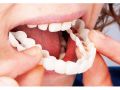 Premium Silicone Decorative Braces – Realistic Fake Braces for Fashion | Artificial Teeth Braces Kit | Non-Metal, Easy-to-Wear Silicone Braces for Teens & Adults. 