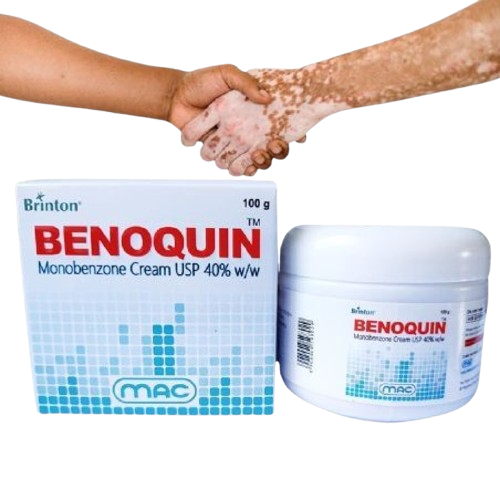 Benoquin%20Monobenzone%20Cream%20New%20In%20Pakistan%20-%20Image%203