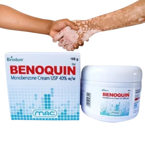 Benoquin%20Monobenzone%20Cream%20New%20In%20Pakistan%20-%20Image%203