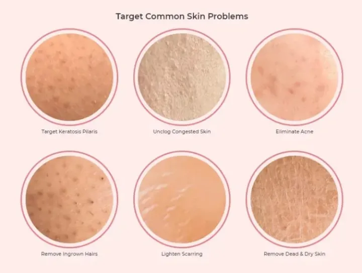 Hot%20Moroccan%20Hammam%20Exfoliating%20Mitt%20Tan%20Removal%20Shower%20Scrub%20-%20Image%208