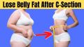 Abdominal Binder/ Body Shaper for Postpartum after C section. 