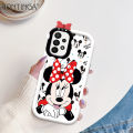 Hontinga for Samsung Galaxy A33 5G Back Cover Gift For Girl Phone Case Monster Lens Camera Protection TPU Cover. 