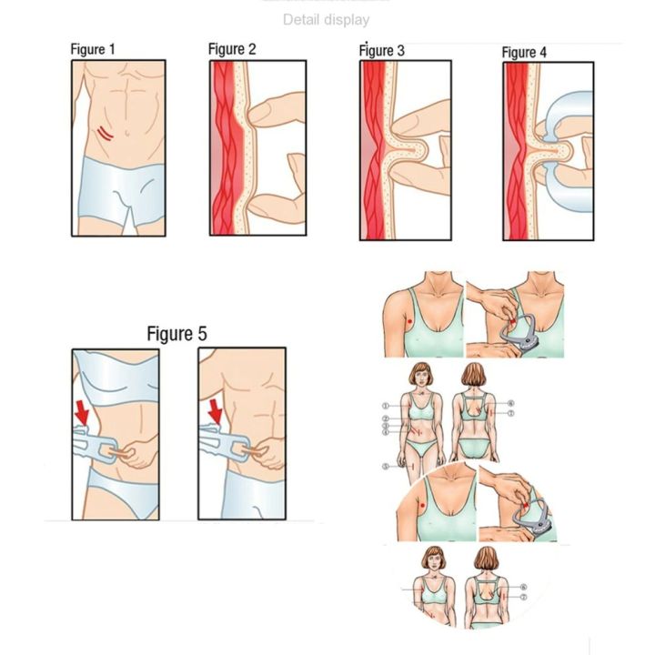 Fat%20Caliper%20Fitness%20Slim%20Measure%20Chart%20Body%20Fat%20Skinfold%20Tester%20Caliper%20Analyze%20-%20Image%207