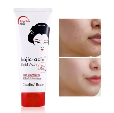 Kojic%20Acid%20Face%20Deep%20Cleansing%20Face%20Wash%20Oil%20Control%20Anti%20Acne%20100g%20-%20Image%202