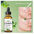 Magic Touch Anti Acne serum with Salicylic Acid for oil Control and acne removal 30 ml with Tea tree oil and Glycolic Acid (AHA). 