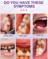 Tooth decay repair Repair all tooth decay, cavities and protect teeth. 