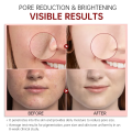 FORT PORE REFINING Serum Niacinamide & Glycolic Acid Serum for Glowing Skin  Dark Spot Correcting  Pore Refining Face Serum  Skin Whitening  Anti-Aging Glass Skin Care 30ml. 