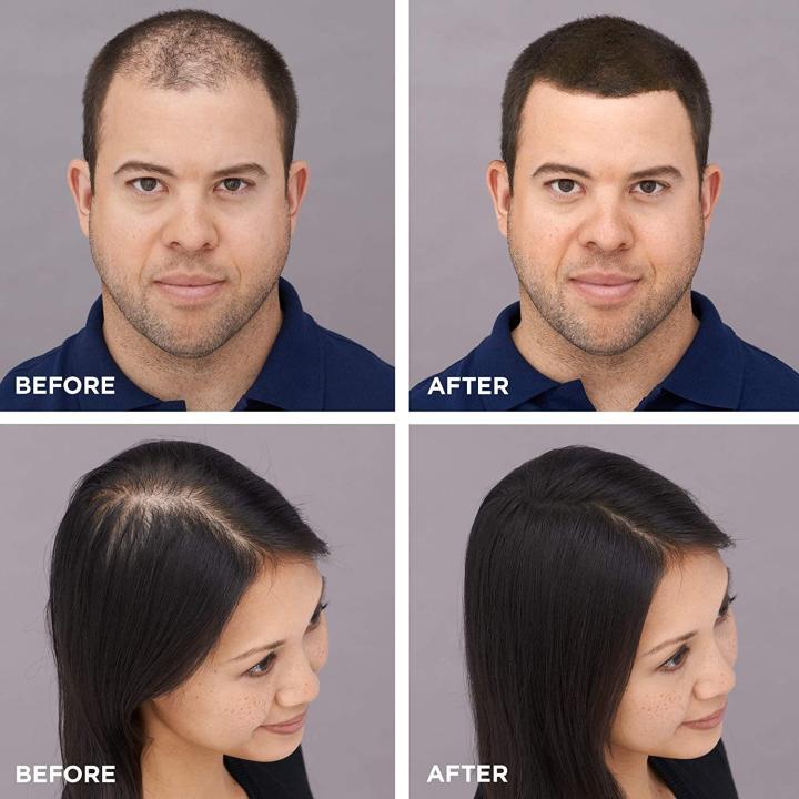 35g%20King%20Hair%20Fibers%20Refill%20(Light%20Brown)%20Best%20alternative%20toppik,%20Caboki,%20Hair%20Fibers%20Refill%20Pack,%20King%20Hair%20Fibers%20100%25%20Natural%20Hair%20Fibers%20Instantly%20Thickens%20Thinning%20or%20Balding%20Hair%20for%20Men%20and%20Women%20-%20Completely%20Conceals%20Hair%20Loss%20in%2015%20Seconds%20-%20Image%202