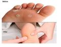 ( chandi cutter) Pedicure remover Foot Hard Dead Skin Corn Cutter Razor with 10 free Blades /  Foot Care Pedicure Callus Shaver Remover Set for Feet 1 Shaver with 10 Replacement Blades for Removing Dead Skin and Hard Skin. 