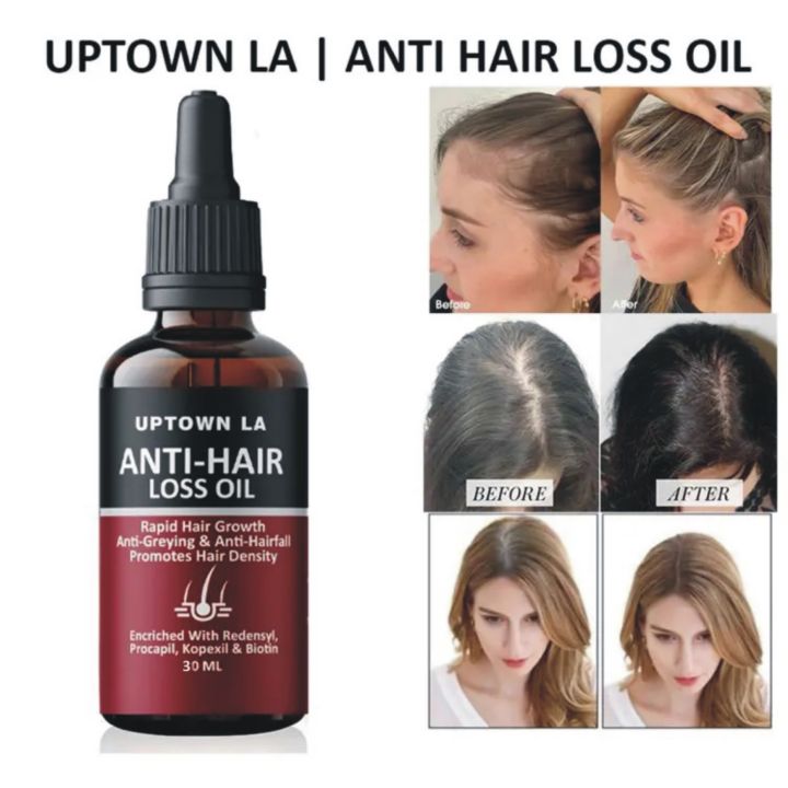Uptown LA Anti Hair Loss Hair Regrowth Oil  30 ml