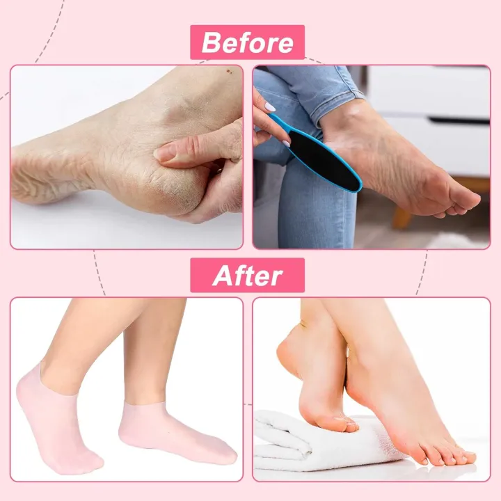 Silicone%20Moisturizing%20Gel%20Heel%20Socks%20%E2%80%93%20Unisex,%20Hydrating%20Foot%20Care,%20Anti-Crack%20Heel%20Pads%20-%20Image%208