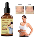 fat burner | fat burner | tummy trimmer oil | slimming fat burning oil | Weight loss oil | Fat burning essential oil | Slimming body oil | Effective fat burning oil | Slimming oil for women and girls | Organic slimming oil. 