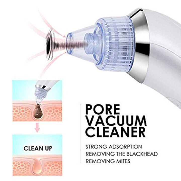 DermaSuction%20Vacuum%20Pore%20Cleaning%20Device%20With%204%20Interchangeable%20Suction%20Heads%20-%20Image%207