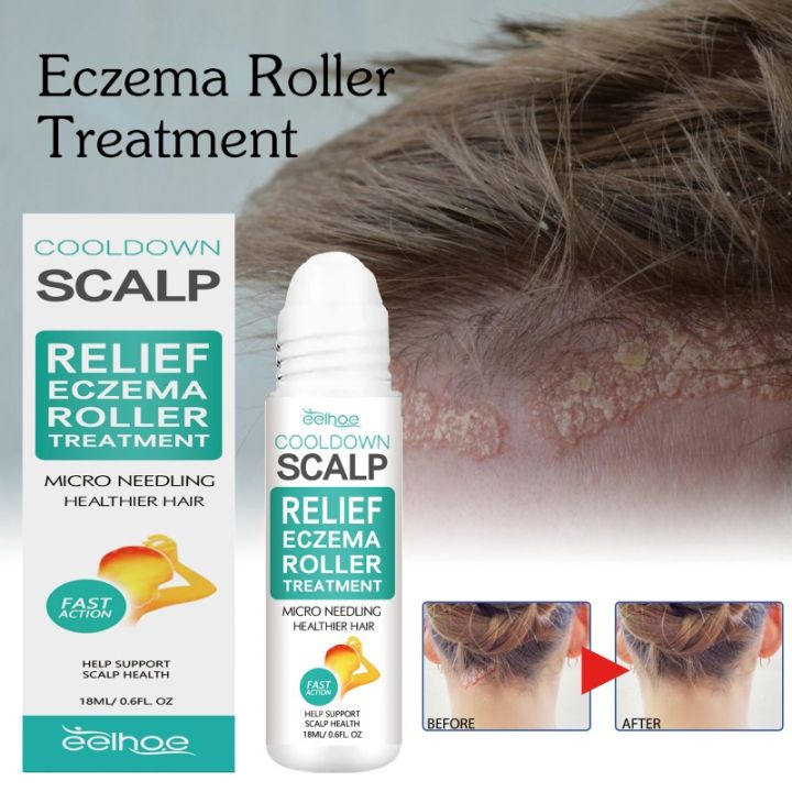 Scalp Care Roller Ball External Use Repair Skin Dandruff and Dandruff Deep Cleansing and Moisturizing Scalp Care Roller Ball
