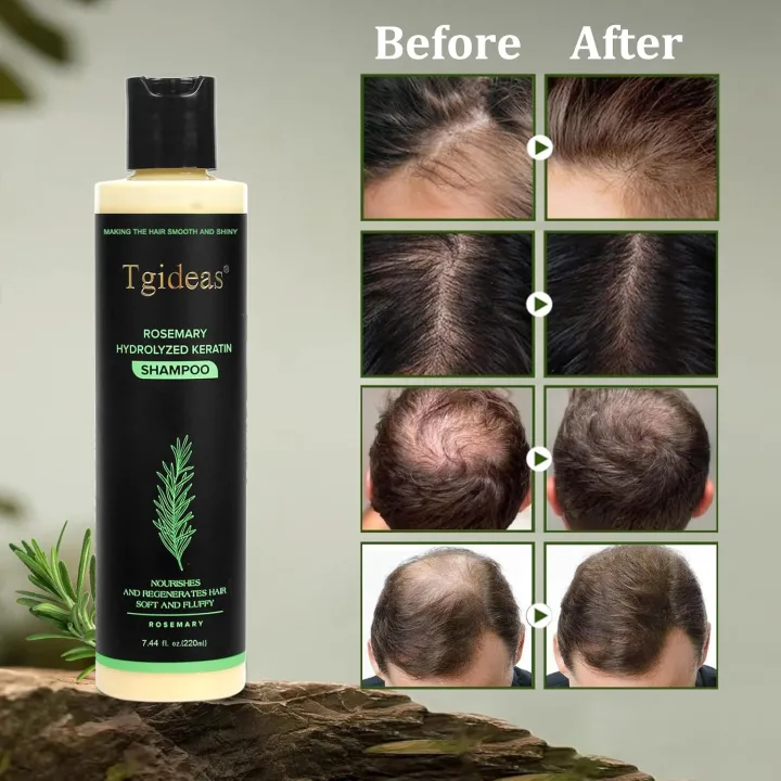 Tgideas%20Organic%20Rosemary%20Hair%20Growth%20Shampoo%20for%20Women%20and%20Men-Natural%20Thickening%20&%20Strengthening%20Shampoo%20with%20Hydrolyzed%20Keratin%20for%20Thinning%20Hair%20&%20Hair%20Loss%207.4%20fl.oz%20-%20Image%206