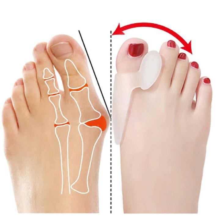 1 Pair Silicone Gel Bunion Protector Toe Straightener Separator Alignment Pain Relief Thumb Corrector Orthotics Feet Care