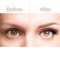 Flawless Brows Flawless Eyebrow Hair Remover with LED Light Rechargeable Flawless Hair Remover for Women Upper Lips Facial Hair Painless Trimmer Instant Hair Remover Machine For Gentle And Smooth Skin Premium Quality For Women. 