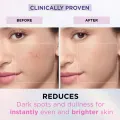 L'Oreal Paris Glycolic Bright Instant Glowing Serum, Reduces 57% Dark Spots, 30ml - Anti-Dark, Spot Brightening Face Serum. 