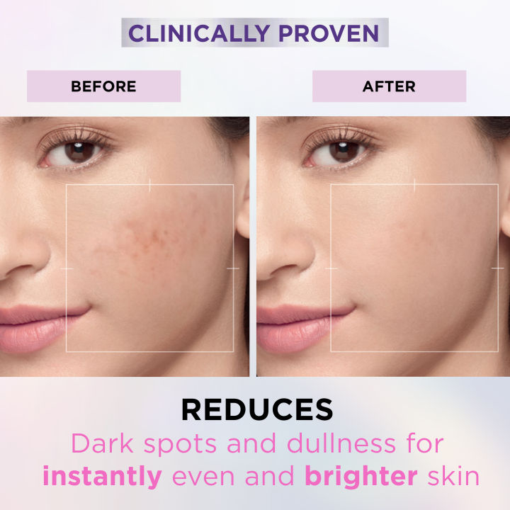 L'Oreal%20Paris%20Glycolic%20Bright%20Instant%20Glowing%20Serum,%20Reduces%2057%25%20Dark%20Spots,%2030ml%20-%20Anti-Dark,%20Spot%20Brightening%20Face%20Serum%20-%20Image%204