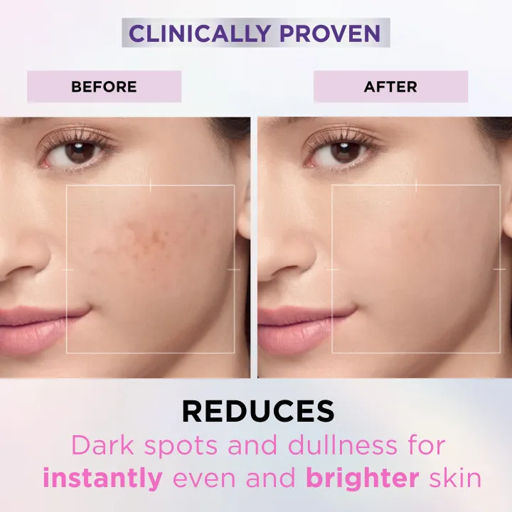 L'Oreal%20Paris%20Glycolic%20Bright%20Instant%20Glowing%20Serum,%20Reduces%2057%25%20Dark%20Spots,%2030ml%20-%20Anti-Dark,%20Spot%20Brightening%20Face%20Serum%20-%20Image%204