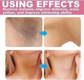 hand%20foot%20whitening%20cream%20best%20night%20formula%20self%20skin%20care%20derma%20winter%20summer%20for%20all%20skin%20types%20skin%20care%20products%20whitens%20soften%20-%20Image%205