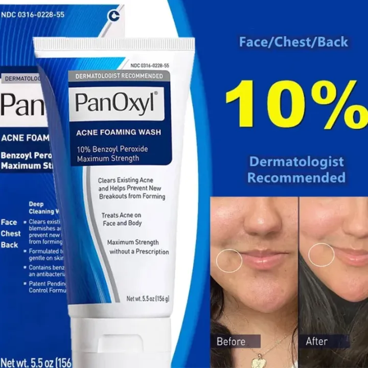PanOxyl%20Acne%20Foaming%20Wash%2010%25%20Maximum%20Strength%201oz%20156ML%20-%20Image%208