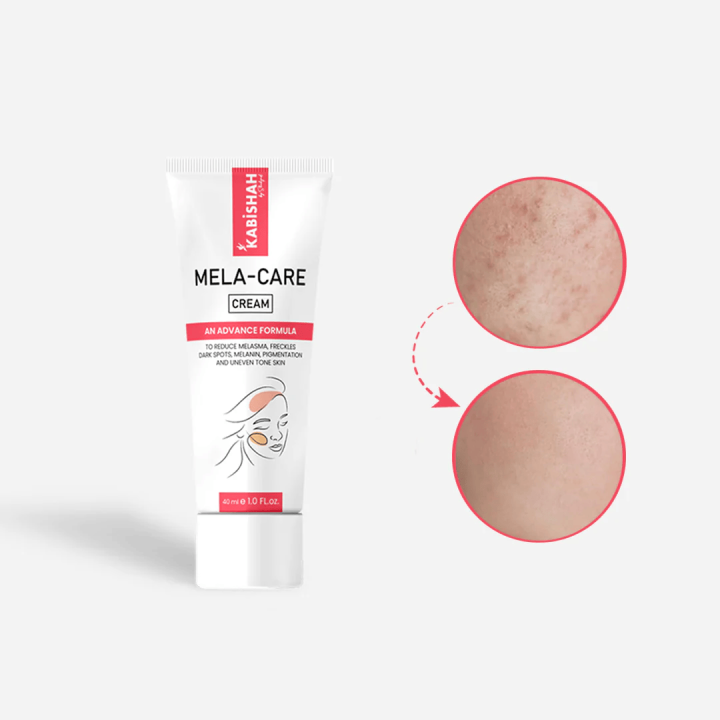 Kabishah%20by%20Shahzad%20Mela%20Care%20Advanced%20Brightening%20Cream%20Double%20Pack%20Bundle.%20-%20Image%202