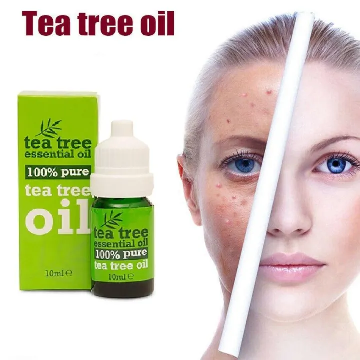 Tea%20Tree%20Oil%20Moisturizing%20%20Face%20Care%2010%20ML%20-%20Image%202