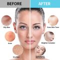 Dr Meinaier Tea Tree Oil Control Oily Skin Acne Dry jelly Mask Powder Facial Hydration 100g. 